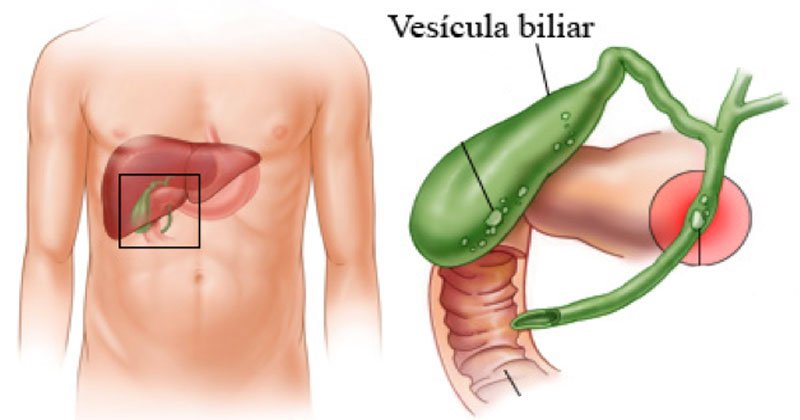 Resultado de imagem para O QUE FAZ BEM PARA O FÃGADO, FAZ BEM PARA VIDA!! - Ervas , frutas para o FÃGADO,e para a VESÃCULA BILIAR